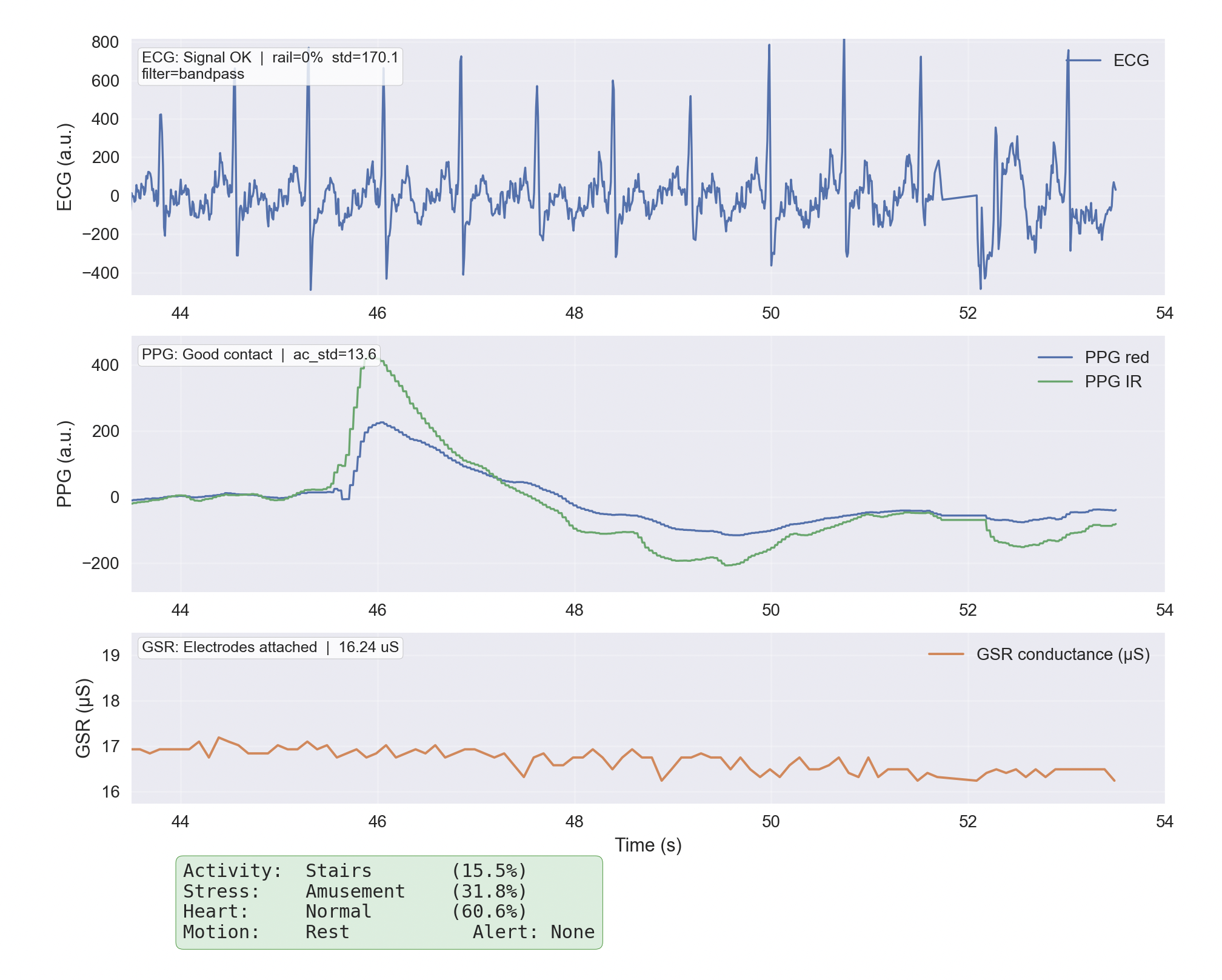 ESP32 prototype with biomedical sensors connected